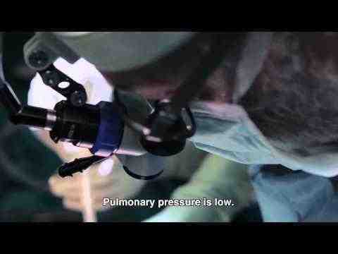 Open Heart - trailer